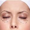 Eye area