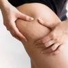cellulite