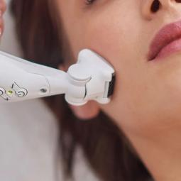 ICOONE LASER SEJAS PROCEDŪRA